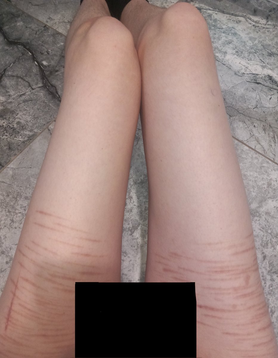 Ivan ☆ tweet media