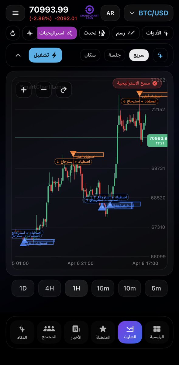 SmartChart Lens tweet media