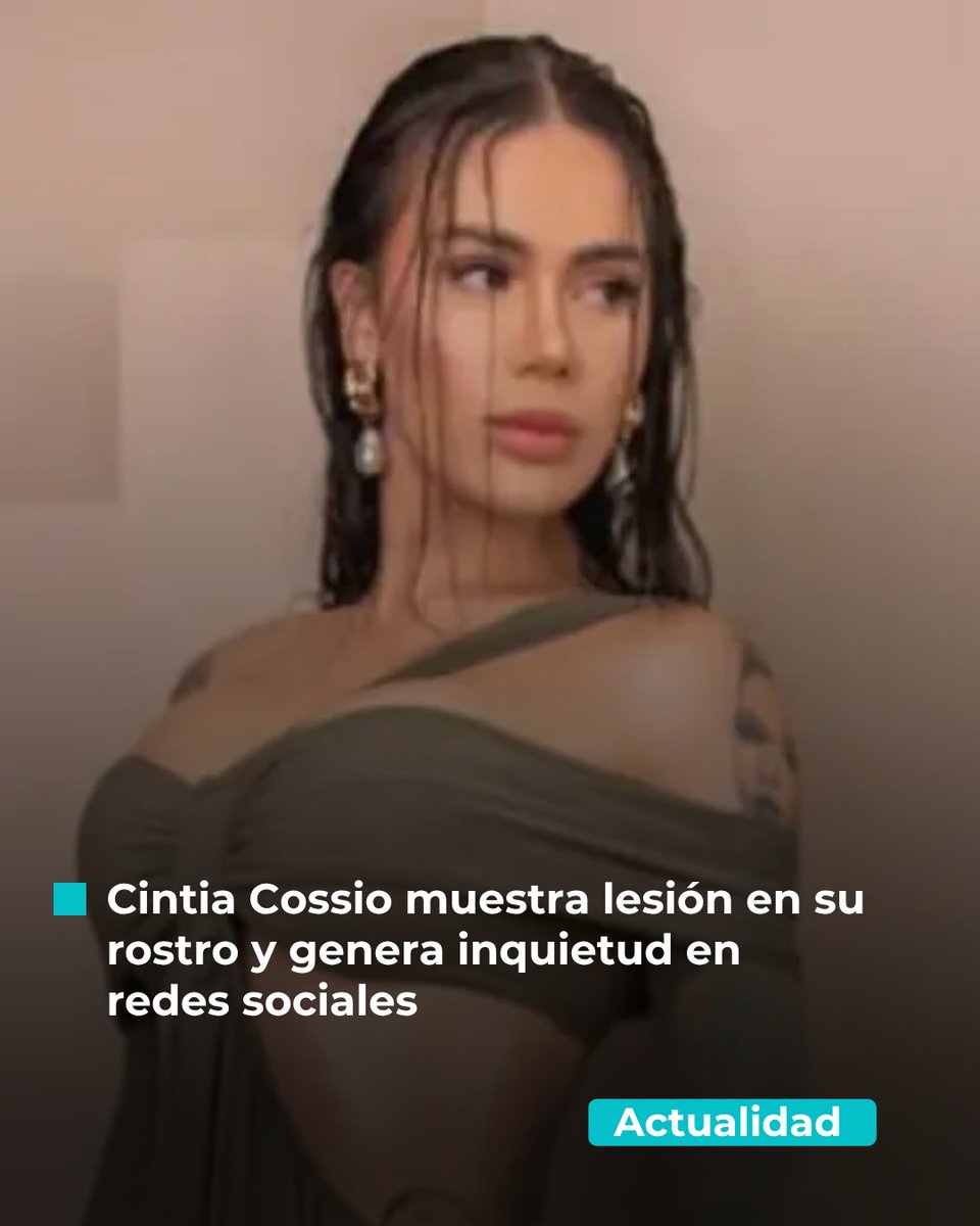CaracolTV's tweet image. 😳💥 tinyurl.com/ye28sntm

#CintiaCossio genera preocupación en redes tras mostrar una lesión en su rostro ⚠️👀 una imagen en su frente sin explicación encendió las reacciones de sus seguidores 💔🔥