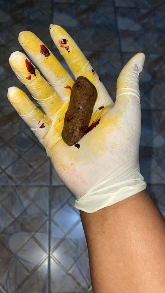 ℕ𝕦𝕣𝕤𝕖 𝔽𝕚𝕠𝕟𝕒🥹❤️💕💋 tweet media