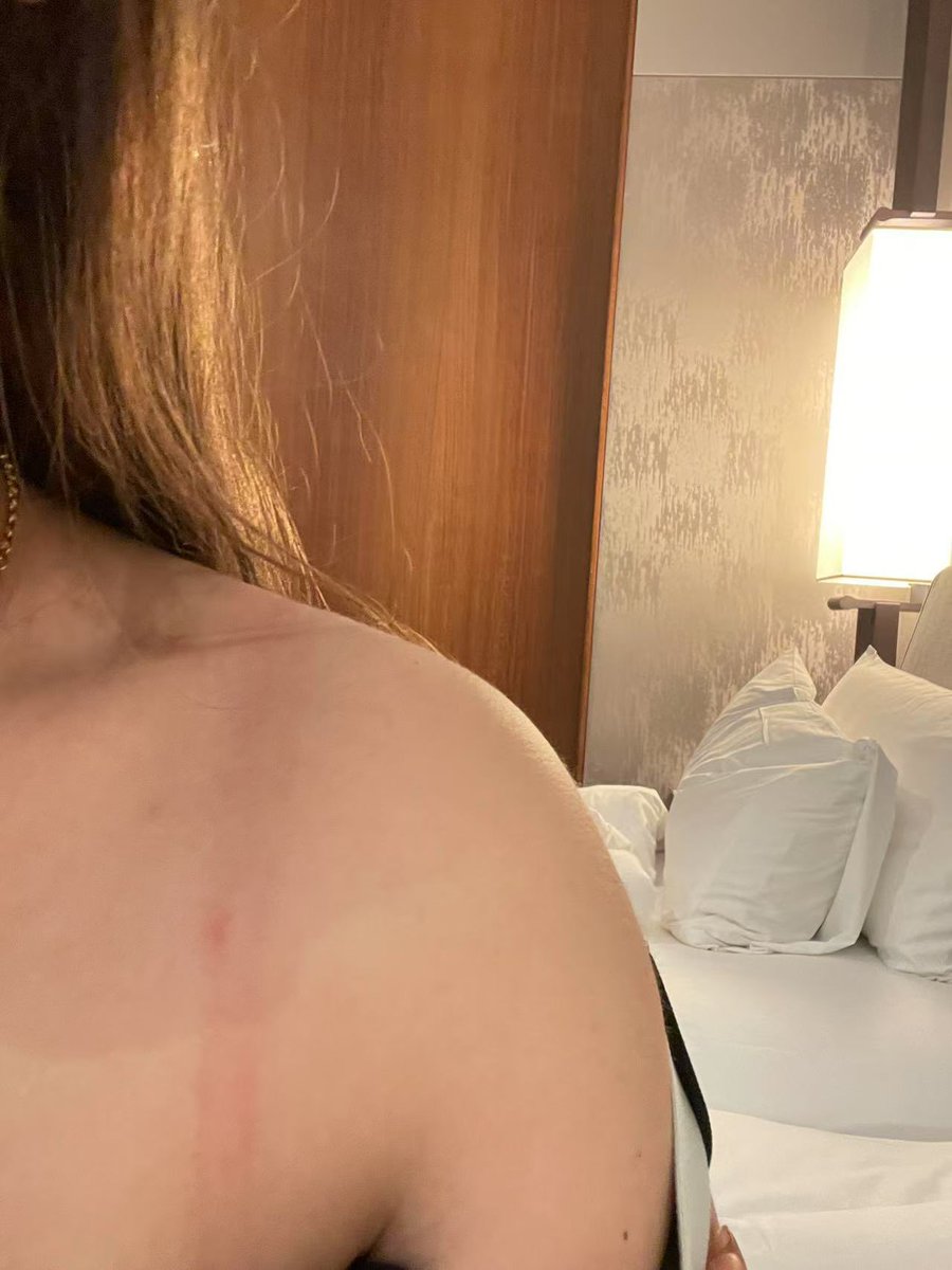 입보지 tweet media