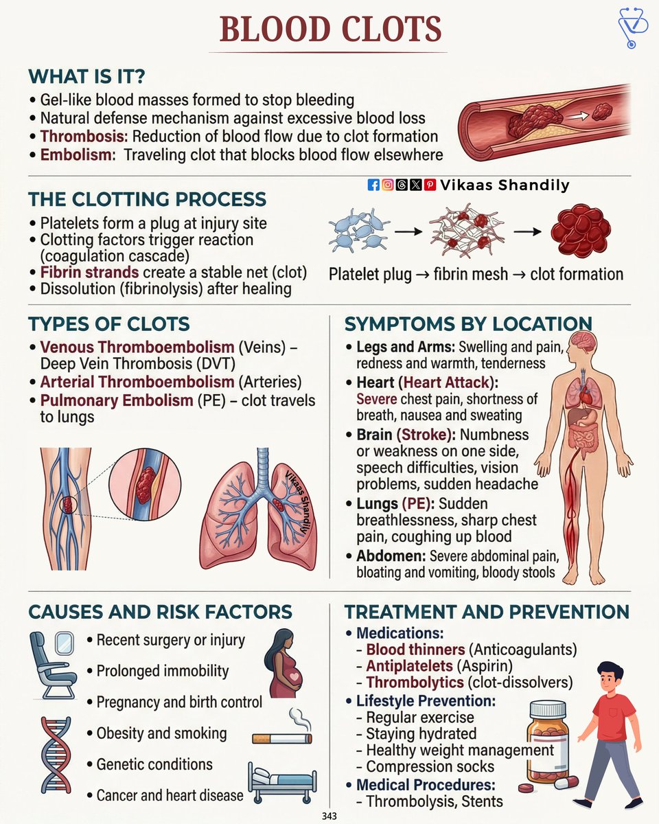 VikaasShandily's tweet image. Blood Clots: Process, Types, Symptoms, Causes and Treatment 
#BloodClots #Thrombosis #DVT #MedEd #VikaasShandily