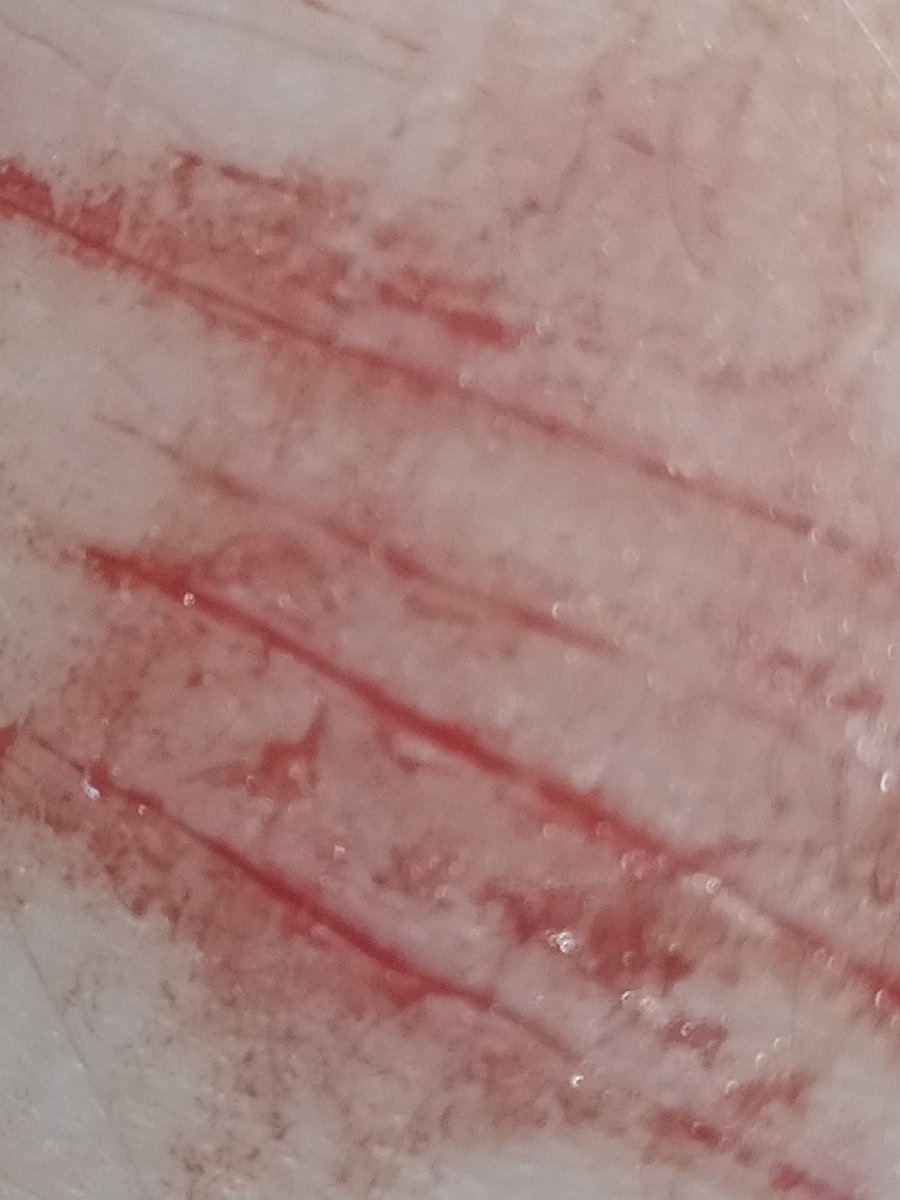 but i still want you | (っ◞‸◟c) tweet media