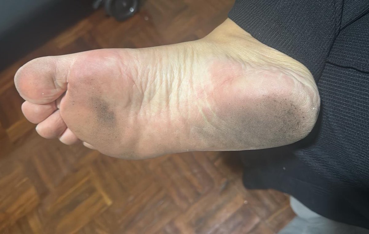 Ari feet tweet media