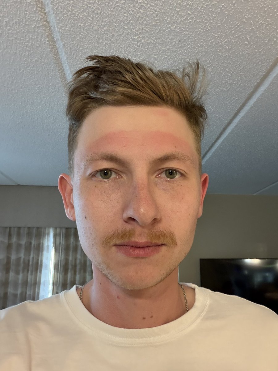WyattzWorId's tweet photo. Jesus Christ I’m never wearing a hat again https://t.co/p0URwjrE42