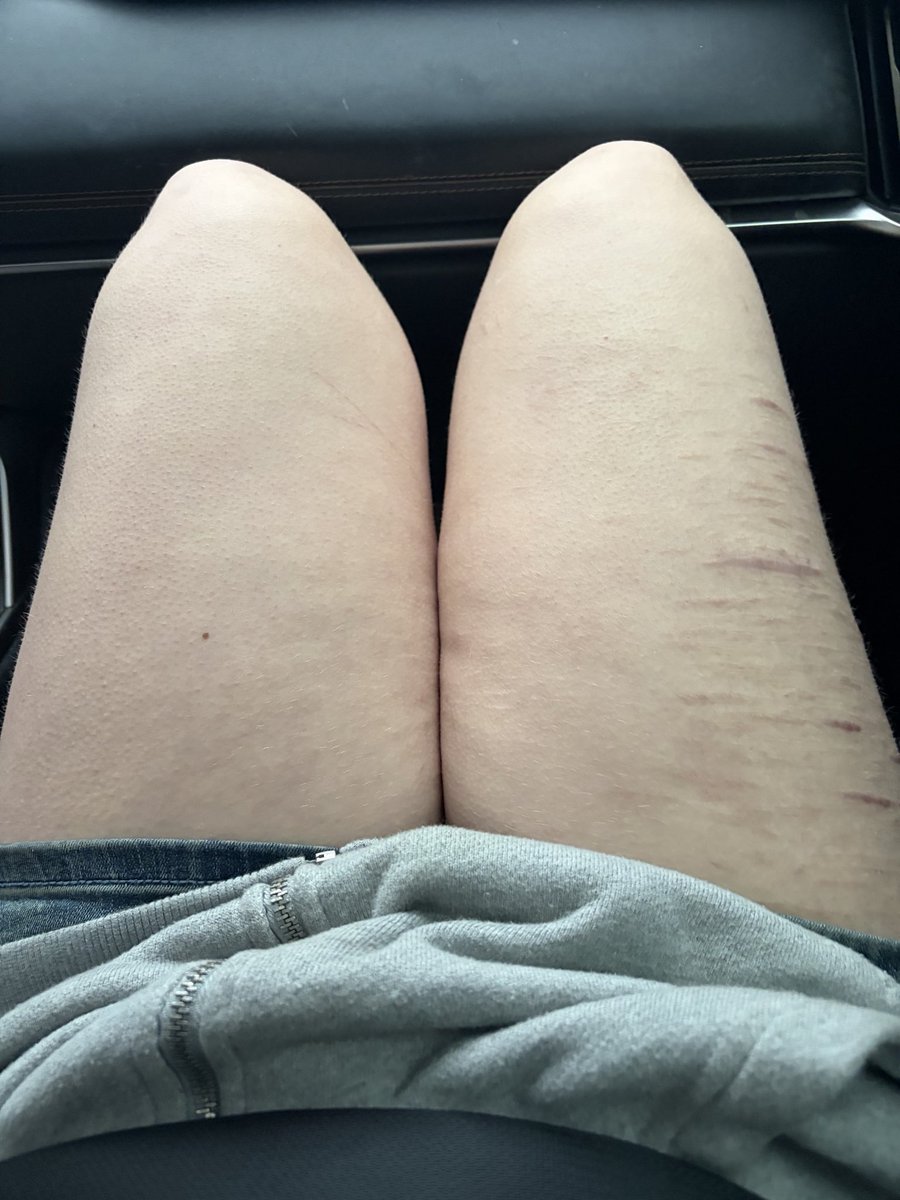 𐂯 。 sae itoshi of RECOVtwt ྀི tweet media