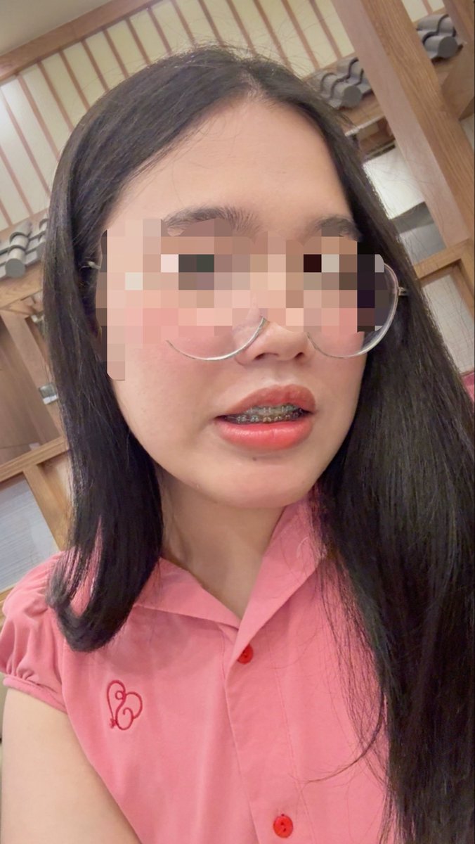 Ari_ailra tweet media