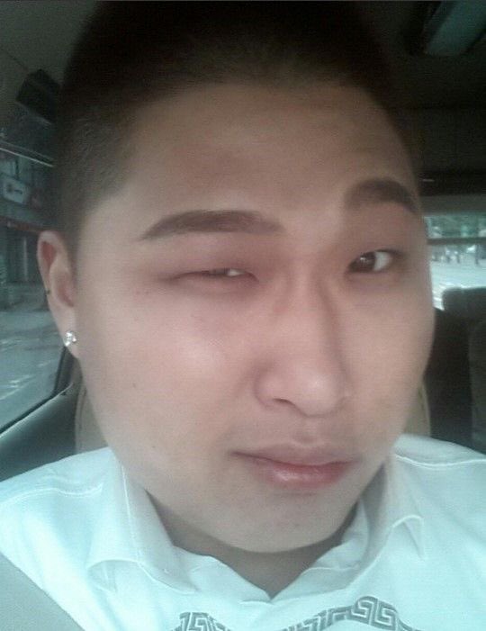 대머리 tweet media