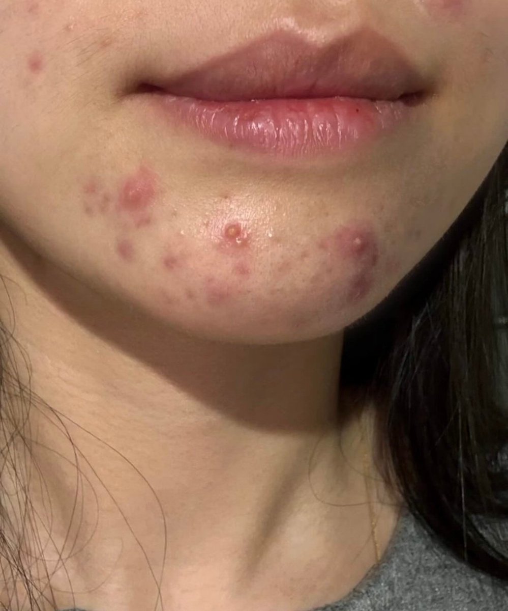 Zeziii🤍 tweet media