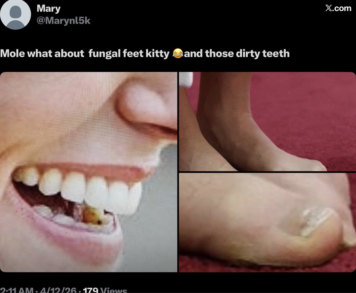 T Anderson tweet media