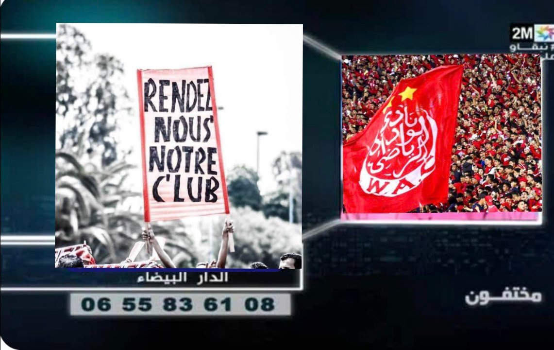 Karima Botox 💉 tweet media