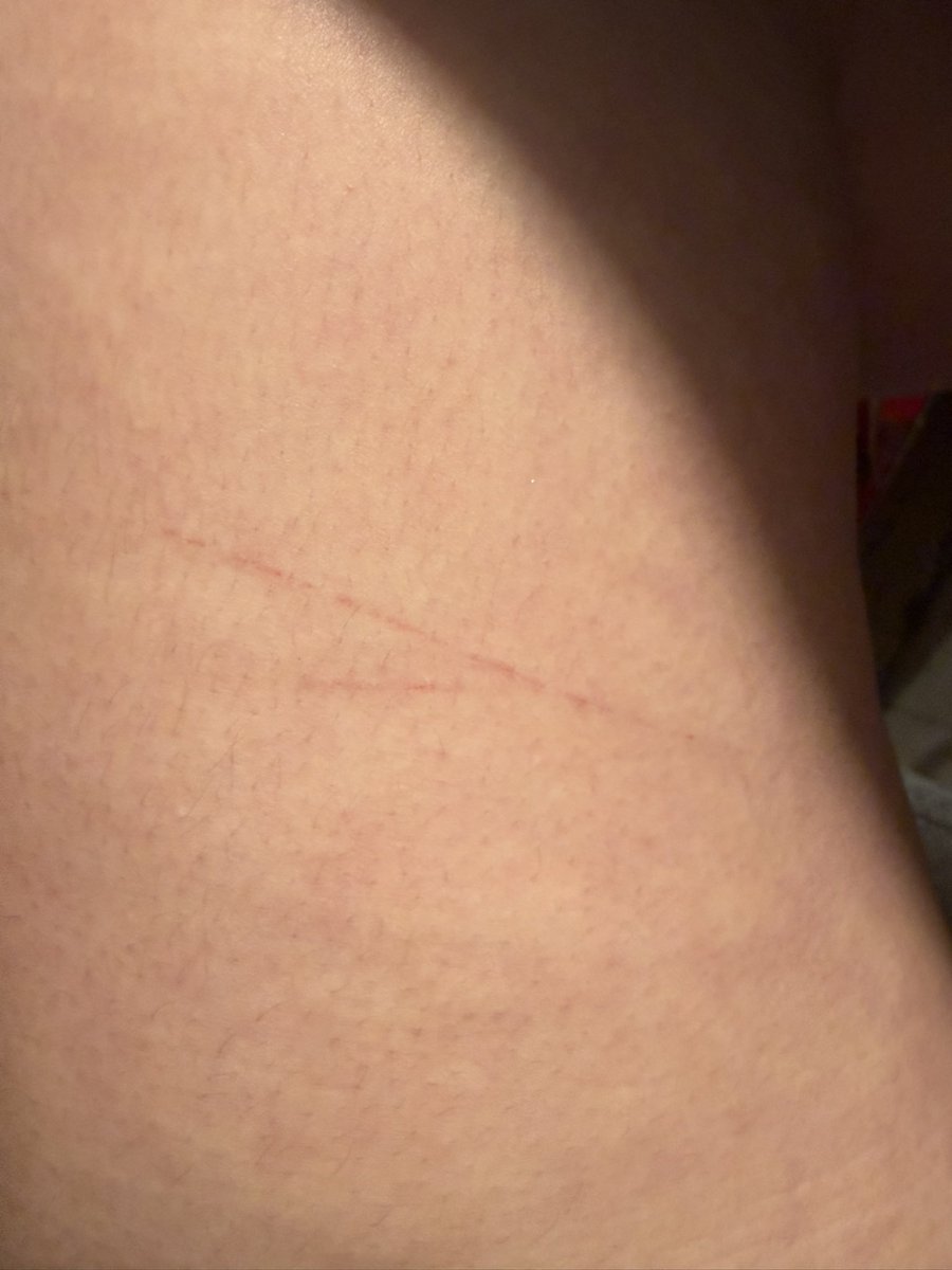 𐂯 。 sae itoshi of RECOVtwt ྀི tweet media