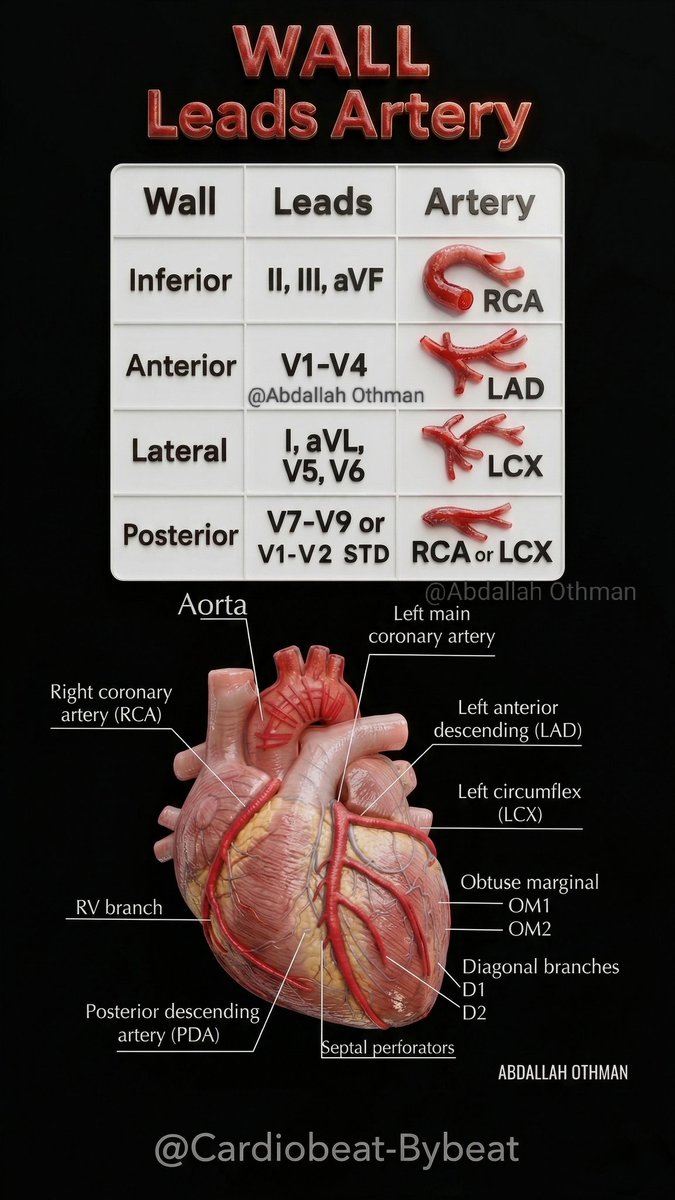 CardioBeat_'s tweet image. facebook.com/share/p/1Cpza9…
🎯 Essential correlation between ECG leads and coronary anatomy. 🫀
#Cardiology #ECG #EKG #STEMI #MI