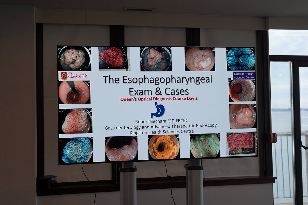 RobertBechara's tweet photo. Fantastic Day 2 of our annual Queen’s Optical Diagnosis Course!

Thank you to all the attendees for coming &amp; for the great questions &amp; discussions.

A special thank you to our guest speaker @YusukeFujiyoshi, for his masterful teaching on early gastric cancer. 

Until next year! https://t.co/0mpPTXgXve