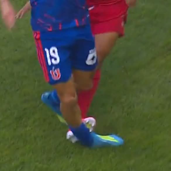 Le hacen esto a un jugador del iglú F.C y es cadena perpetua... increíble...
#VamosLaU 🔵🔴🤘🏼
#UDeChile