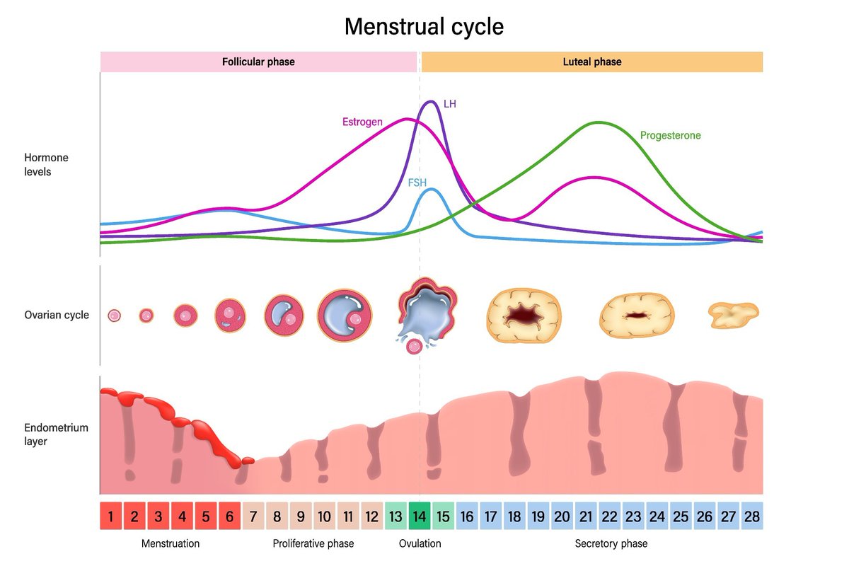 NewsMedical's tweet image. New research reveals strength and mood shift independently across menstrual phases for athletes 💪🧠. One-size-fits-all training might not work. news-medical.net/news/20260412/… #Menstruation #SportsScience @SciReports