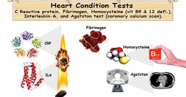 healthyojas's tweet image. 5 Heart Condition Tests: CRP, Fibrinogen, Homocysteine, IL-6 &amp;amp; #Agatston test #Cholesterol buff.ly/rh8dvZU #Heart #CRP #Fibrinogen #Homocysteine #IL-6