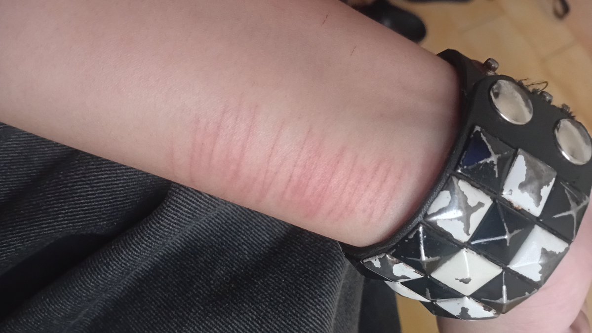 Drogadiktoo's tweet image. #shtwt mamá m rasguño el gato :(((