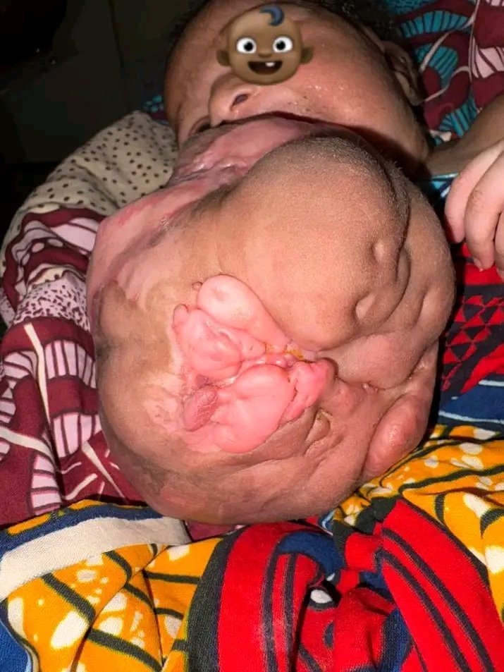 Dr. Chibuike M. tweet media