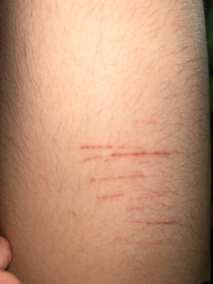 Meteor of shedtwt tweet media