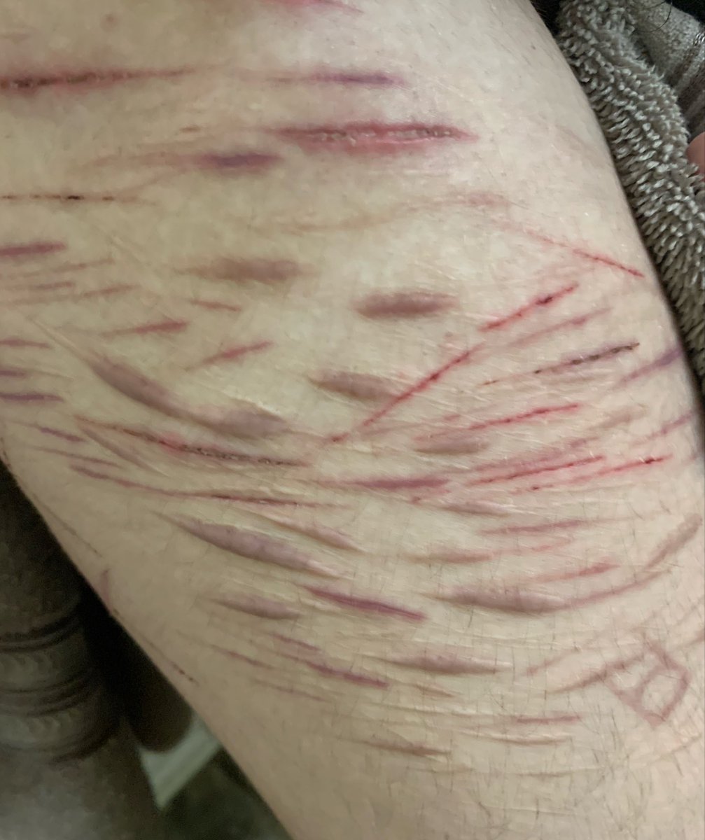 f3rret_thing's tweet image. purrrplleee🤤
sfx makeup!! #fake #shtwt