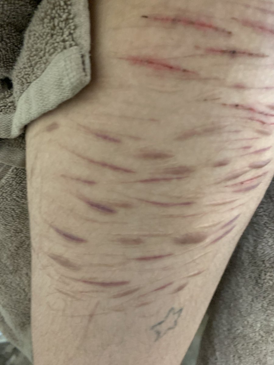 f3rret_thing's tweet image. purrrplleee🤤
sfx makeup!! #fake #shtwt