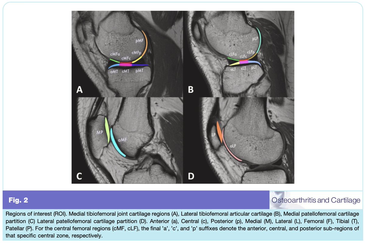 Osteoarthritis and Cartilage Journals tweet media