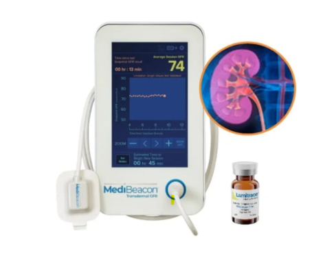 KIReports's tweet image. 1/ Hey #NephTwitter!👋
We’re back with a fresh #XTorial
We spend half our lives worrying about how bad creatinine is.. then keep using it anyway.
What if we could measure GFR at the bedside - no serial blood samples? Let’s talk transdermal GFR (tGFR).
#MedTwitter @ISNkidneycare