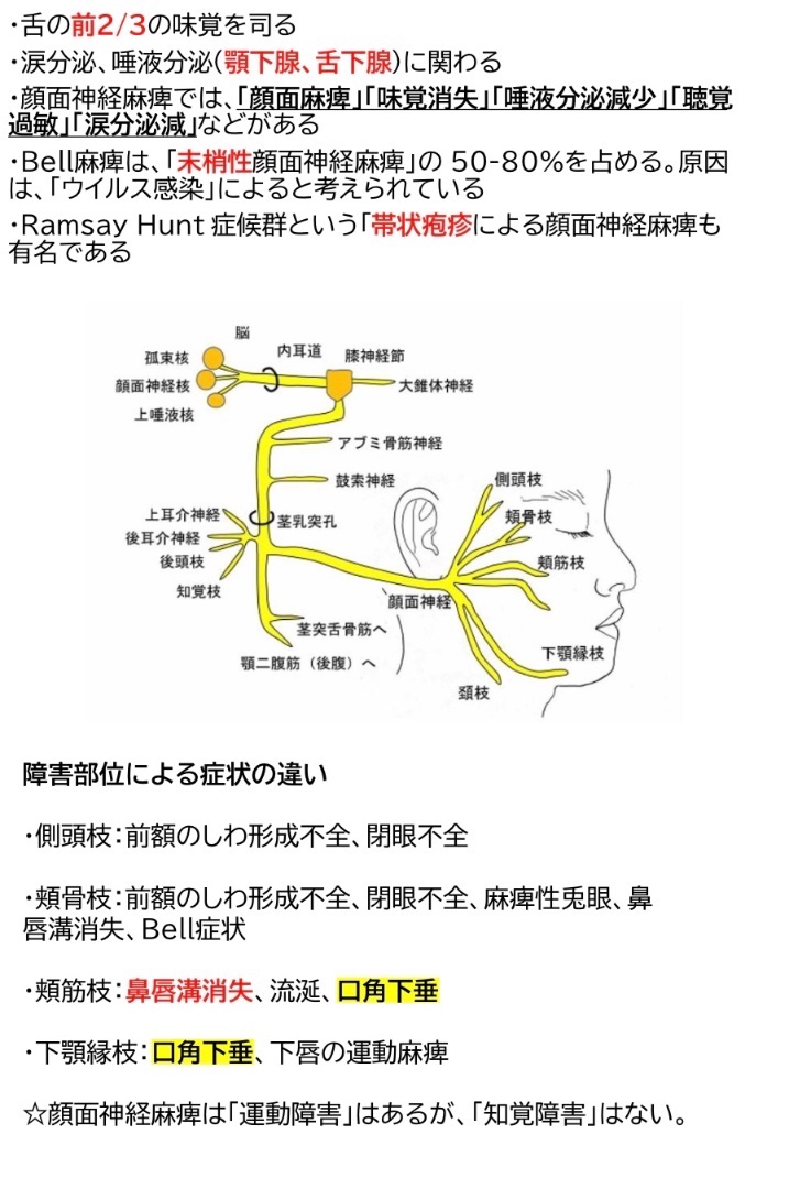 ロムニーハウス 歯科医師国家試験分析ノート 🦷国試ポイント 顔面神経麻痺 障害部位の症状を把握することが、大切です。