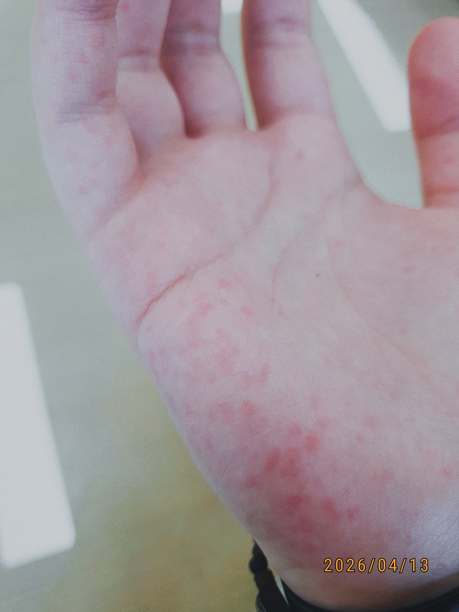 눅눅감튀 tweet media