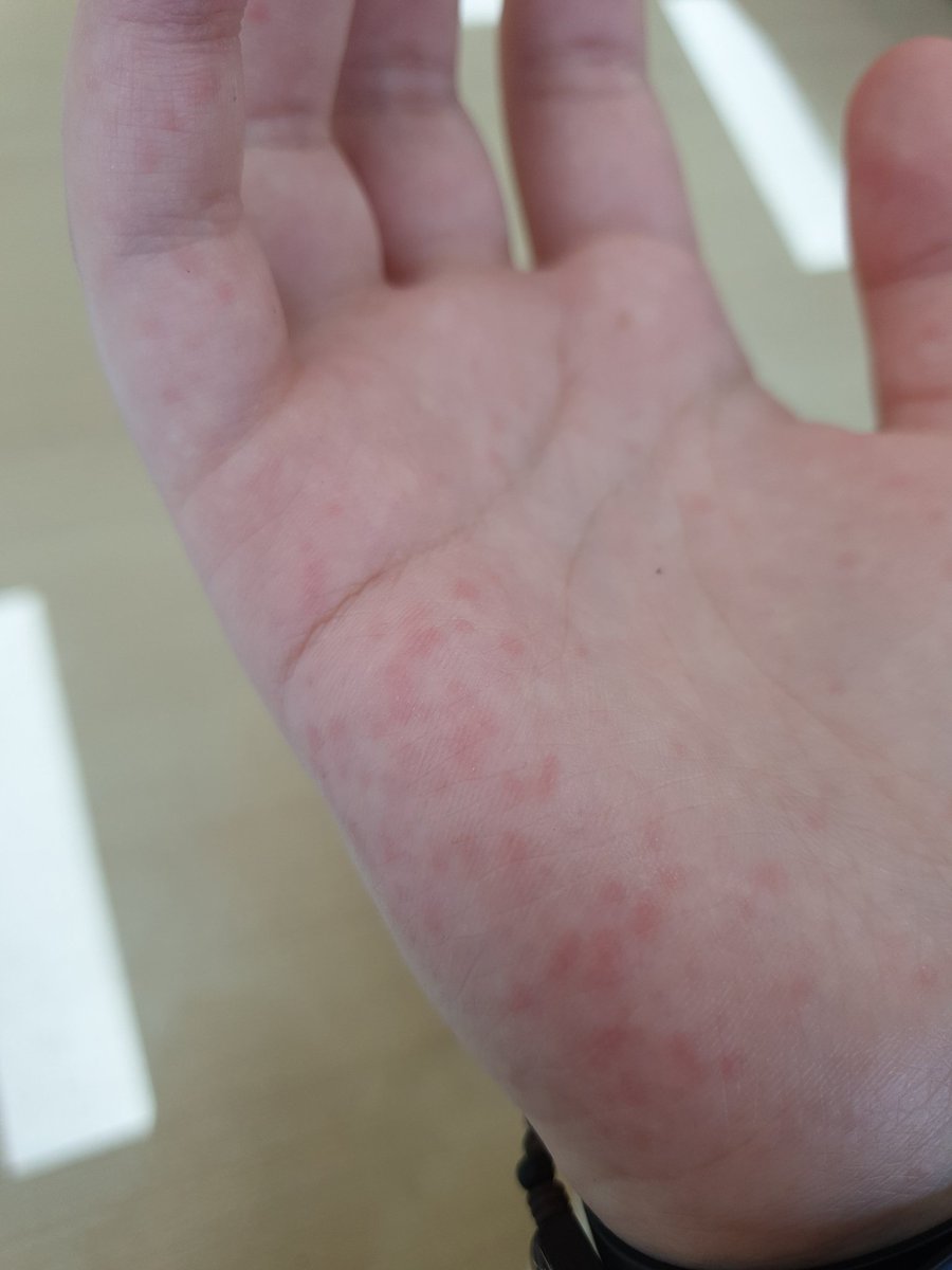 눅눅감튀 tweet media