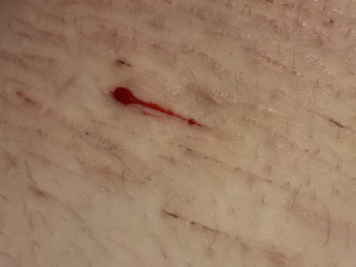 ⋆‧°𓏲ּ𝄢 of shedtwt + suicidetwt tweet media