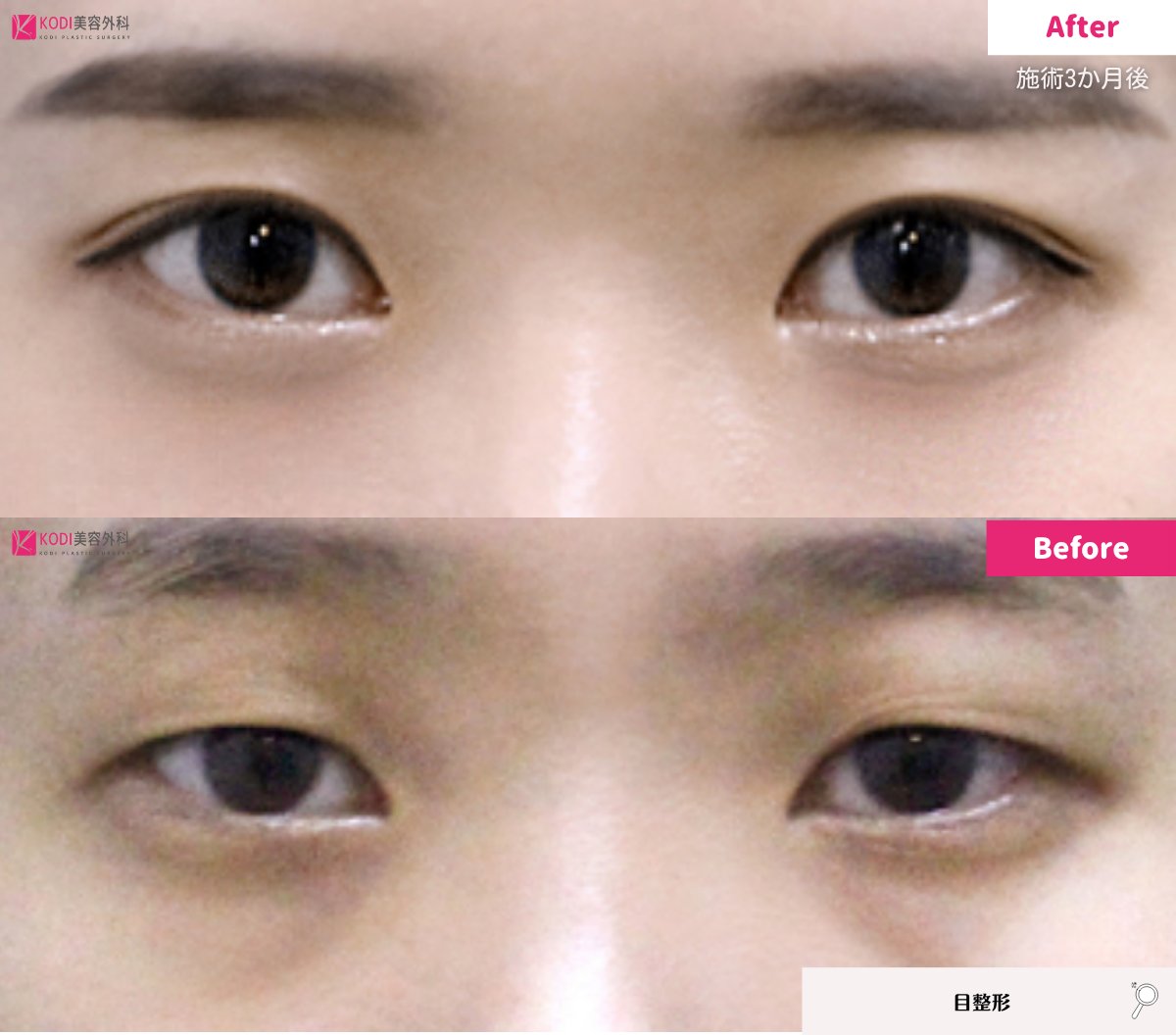 KODI美容外科💖江南でフィラーするならコディ💖 tweet media