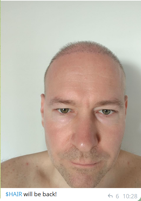 Hair Token 💈 tweet media