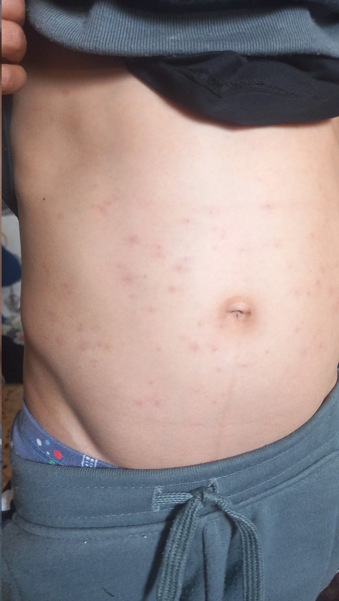 omarbassam tweet media