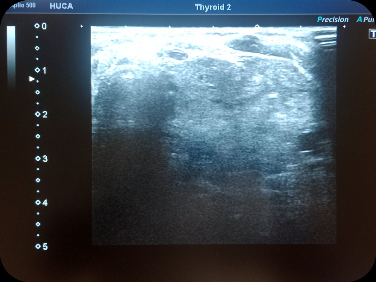 Interventional Ultrasound for Pathologists tweet media