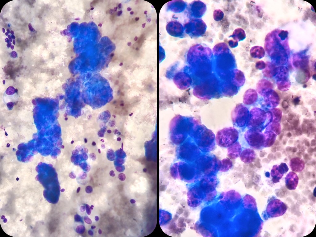 Interventional Ultrasound for Pathologists tweet media