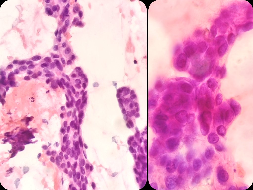 Interventional Ultrasound for Pathologists tweet media