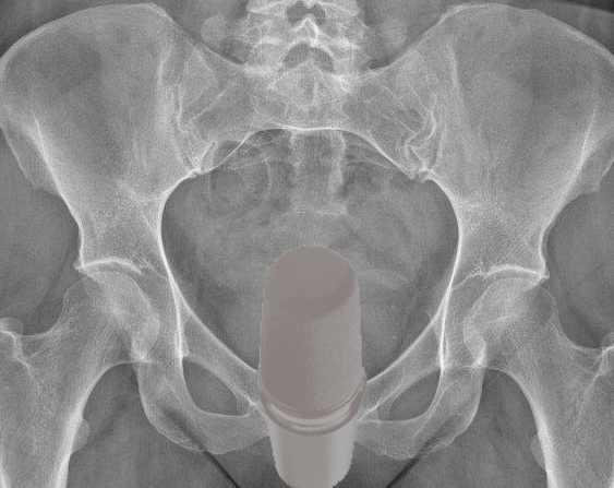 Lord Umbra 🗡️📜 tweet media