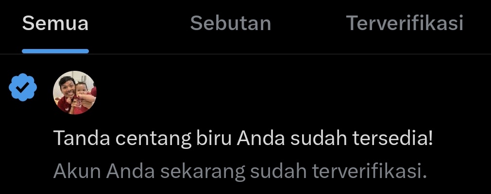 Afri Anes 🔴 | YNWA tweet media