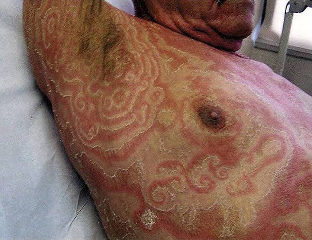 Itebimien Peter tweet media