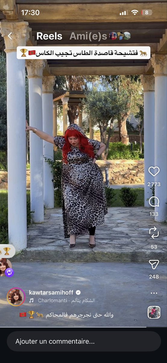 Karima Botox 💉 tweet media