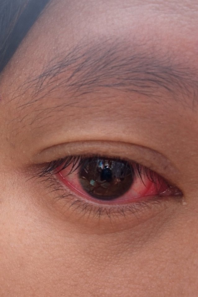 น้องผัก tweet media