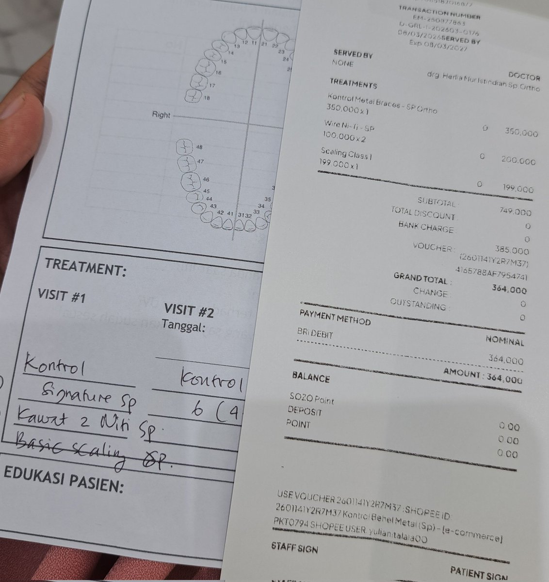 jurnalgigiku's tweet photo. Kontrol kelima
Seperti biasa, ganti kawat. Sama kali ini ada tambahan scaling juga.
Total = kontrol + kawat + scaling - voucher shopee
= Rp350rb + Rp200rb + Rp199rb - Rp385rb = Rp364rb https://t.co/ilAVXjRhER