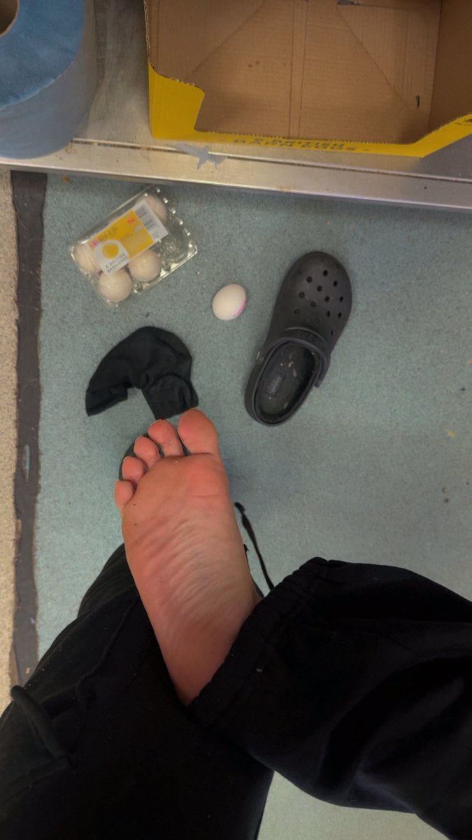 The urge to crush this egg at work is so real 🤣🤣🤣