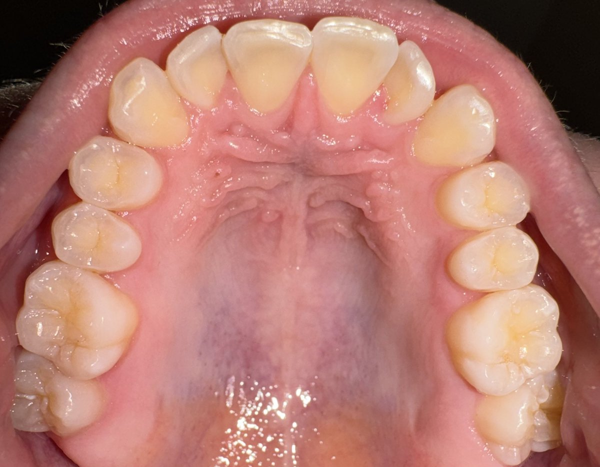 rui ─ ★ till irl tweet media