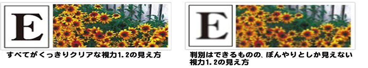 Love0308mc's tweet photo. @mikanthief そういうことなんですね…😂

眼科のメガネで、1.2が左の「E」ようには見えず、右のようなぼやけるような感じでも、ICL入れたら少しははっきり見えるようになるのでしょうか…？
何点も伺ってすみません😭 https://t.co/80XX1vFhFa