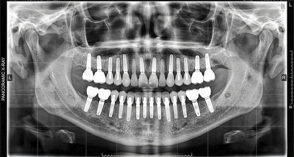 ibrahim ozan mutlu tweet media