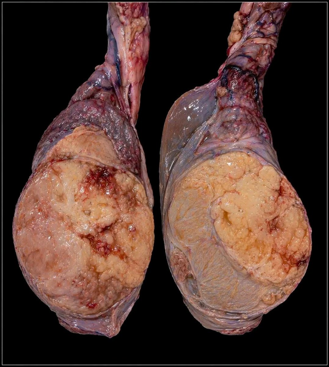 Naseem Suhail, MD tweet media