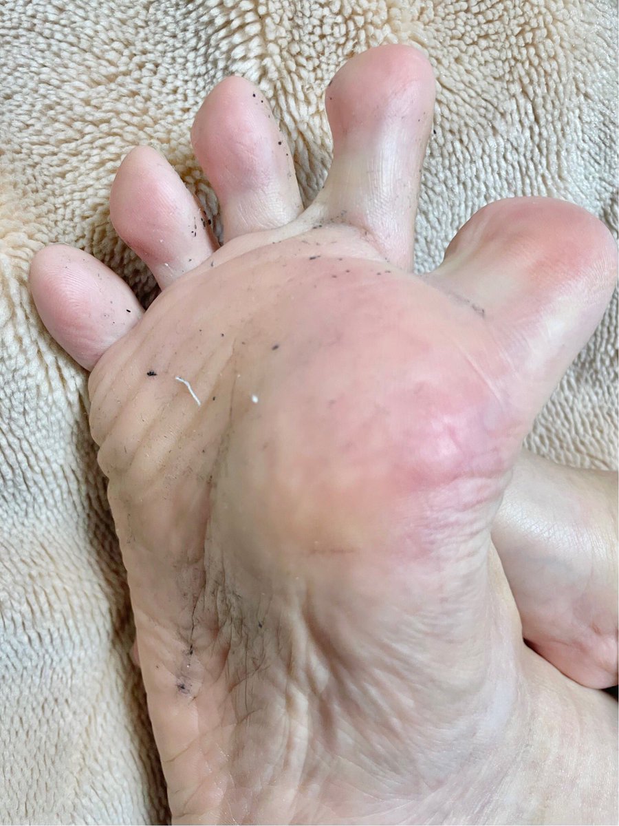 アクア病み赤ちゃん👶 tweet media